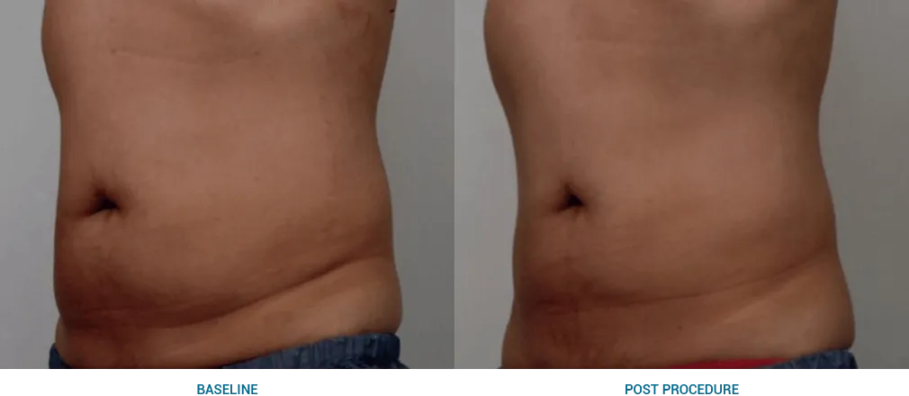 imgi_40_Abdomen_03